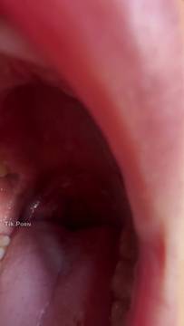Blonde beauty opens wide teasing for the camera #Solo #Blonde #Sexy #Cumshot #ThroatExposing #teasing