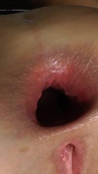 Film Porno Anal Gaping by Evil Angel & POV Extreme Hardcore